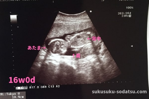 妊娠 18 週 性別 妊娠18週：おなかの張り具合および胎児の発育